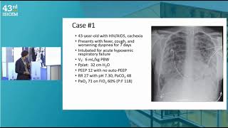 INDIVIDUALIZING VENTILATOR MANAGEMENT IN ARDS 2024 [upl. by Auoz]