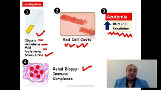 Acute glomerulonephritis AGN Quick Review cme internalmedicine medicalstudent محاضراتباطنة [upl. by Elinore401]