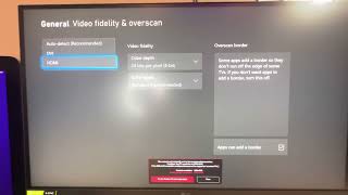 Xbox Series X 1440p 120hz on Lg GN800B not working HERE IS THE SOLUTION [upl. by Cochrane]