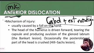 Anterior Shoulder Dislocation Mechanics easily explained [upl. by Hali]