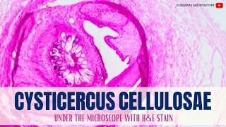 Cysticercus cellulosae under the microscope with Haematoxylin and Eosin HampE stain [upl. by Ytok]