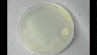 Bacterial Growth  Timelapse [upl. by Cameron]