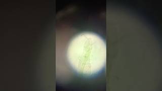 Rotifers undermicroscope bacteria labtech microbiology [upl. by Anniahs61]