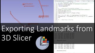 Exporting Landmarks from 3D Slicer [upl. by Heilner]