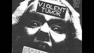 Violent Tumor  Abortion [upl. by Bora]