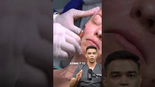 This procedure is called Fat grafting [upl. by Arad987]