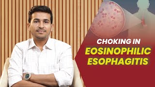 Choking In Eosinophilic Esophagitis  Dr B Padam Kumar [upl. by Casteel]