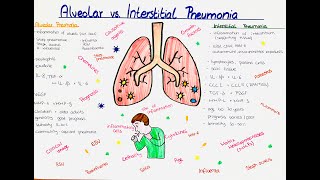 Alveolar vs Interstitial Pneumonia comparison [upl. by Hannahs]