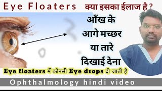 eye floaters  eye floaters treatment  आँख के आगे जाले दिखाई देना  floaters in eye [upl. by Amilb]