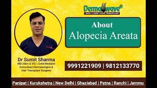 Alopecia Areata Signs Symptoms Causes amp Hair Regrowth Treatments  Alopecia Treatment  Dermawave [upl. by Navy]