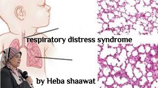 respiratory distress syndromeمتلازمه الضيق التنفسي للاطفال المبتسرين [upl. by Nika874]