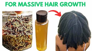 Rosemary And Clove Oil for Massive Hair Growth [upl. by Lrac394]