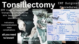 tonsillectomy  ent viva preparation  ent surgical procedures  selflessmedicose [upl. by Rodolph]