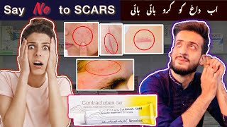 Contractubex Gel  Say “NO” to SCARS  Get rid fo scars Quickly  Merz Pharma Germany 🇩🇪 [upl. by Lundquist185]