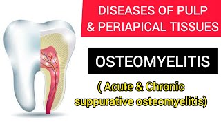 OSTEOMYELITIS ACUTE amp CHRONIC SUPPURATIVE [upl. by Papagena544]