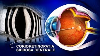 Corioretinopatia sierosa centrale CSCR terapia wwwoculisticaTVit [upl. by Delainey116]