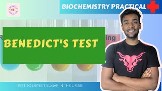 Benedict Test URINE TEST FOR SUGAR  BIOCHEMISTRY PRACTICAL with viva questions [upl. by Anaizit]