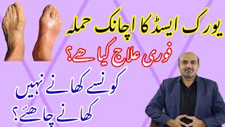 Acute Gout Attack  How To Manage Acute Gout  What Foods To Avoid In Chronic Gout  dr afzal [upl. by Oilut]