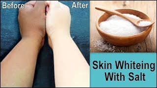 How to Remove Dark Spots using Salt Remove Sun Tan Rough Skin Easily at homeGet Fair skin [upl. by Ttcos870]