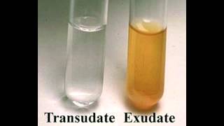 Transudate vs Exudate [upl. by Shandy]