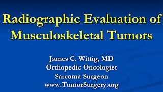 Orthopedic Oncology Course  Radiology of Musculoskeletal Tumors  Lecture 2 [upl. by Eylsel]