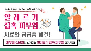 알레르기 접촉 피부염 치료와 궁금증 해결 피부과 전문의가 알려주는 피부 알레르기의 치료 [upl. by Adyahs]