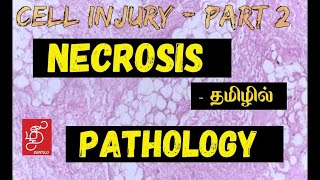 NECROSIS  IN TAMIL GENERAL PATHOLOGY [upl. by Aevin]