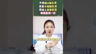 女生大腿内侧黑黑的，“穿短裙的尴尬”你有经历过吗？色素沉着变白医学科普 [upl. by Fabrienne]