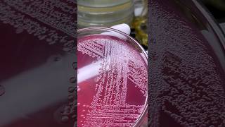 microbiology bacteria fungi chemistry microscopic microorganisms experiment parasites virus [upl. by Schecter]