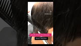 Hair Patch Delhi  9643760504 [upl. by Uis]