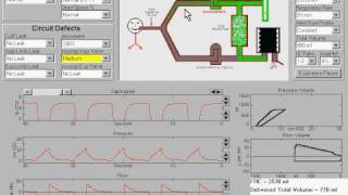 Incompetent Inspiratory Valve in Anesthesia Machine [upl. by Eiser893]