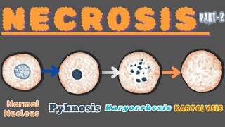 “Nuclear Metamorphosis Exploring Pyknosis Karyorrhexis and Karyolysis” Necrosis part 2 [upl. by Gaile]