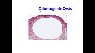 Odontogenic Cysts [upl. by Ddahc]