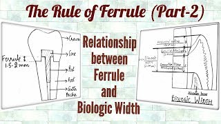 Ferrule Effect Part2 Relationship between Ferrule and Biologic Width [upl. by Seroled]