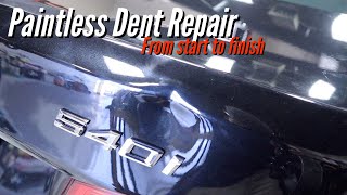 Bmw 540i Large Dent Repair  Dentless Touch  Washington DC [upl. by Thorstein]