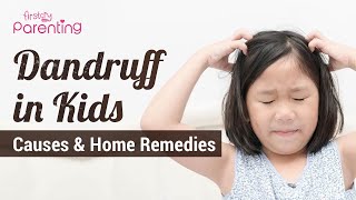 Dandruff in Children  Causes and Remedies [upl. by Bouchier]