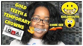 NO MORE GOLD TEETH MY NEW TEETH TEMPORARY CROWNS GOLD TEETH [upl. by Eylsel]