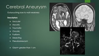 Intracranial aneurysms  NEW  fixed pointer [upl. by Iaria]