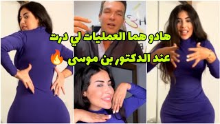 هادو هوما 3 العمليات لي درت عند الدكتور بن موسى🔥 كي جاتكم النتيجة 😍 Soukaina Glamour [upl. by Antoinetta316]