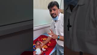 polydactyly syndactyly and dolichocephaly  a case demonstration [upl. by Aihsak]