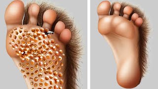 ASMR Remove Pebbles From Foot l Deep Cleaning Animation [upl. by Cole]