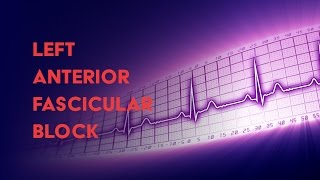 Left Anterior Fascicular Block  How to Read an Electrocardiogram EKG  MEDZCOOL [upl. by Erving]