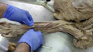 Dissection  Revision of muscles of the front of the forearm [upl. by Proffitt]