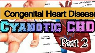 Approach to Acyanotic heart disease and management by Dr Ritesh Sukhramwala Pediatric Cardiologits [upl. by Earley]