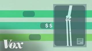 How singlepayer health care works in 2 minutes [upl. by Eissalc]