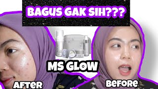 REVIEW MS GLOW PART 2  PENYEBAB JADI JERAWATAN [upl. by Arednaxela967]