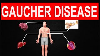 Gaucher Disease [upl. by Adnohsad943]