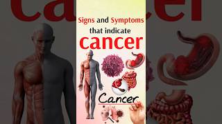 signs and symptoms that indicate cancer [upl. by Efrem]