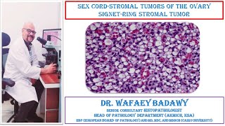 SEX CORD STROMAL TUMORS OF THE OVARY SIGNET RING STROMAL TUMOR BY DR WAFAEY BADAWY [upl. by Lorilyn276]