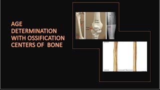 AGE DETERMINATION WITH OSSIFICATION CENTRES OF BONES [upl. by Hgielanna]